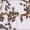 Alternaria alternata - Microscopie (culture EM)